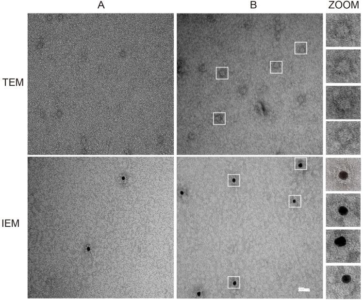 https://cdn.ncbi.nlm.nih.gov/pmc/blobs/f2b8/10929646/1ecc1e219c97/IJN-19-2429-g0004.jpg