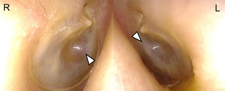 https://cdn.ncbi.nlm.nih.gov/pmc/blobs/f2b9/11452142/e6a0c375d227/amjcaserep-25-e945301-g002.jpg