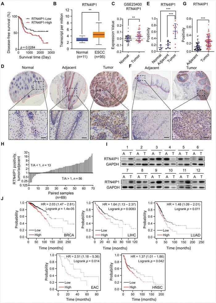 https://cdn.ncbi.nlm.nih.gov/pmc/blobs/f2bc/11848606/3839c709d280/ADVS-12-2406220-g004.jpg