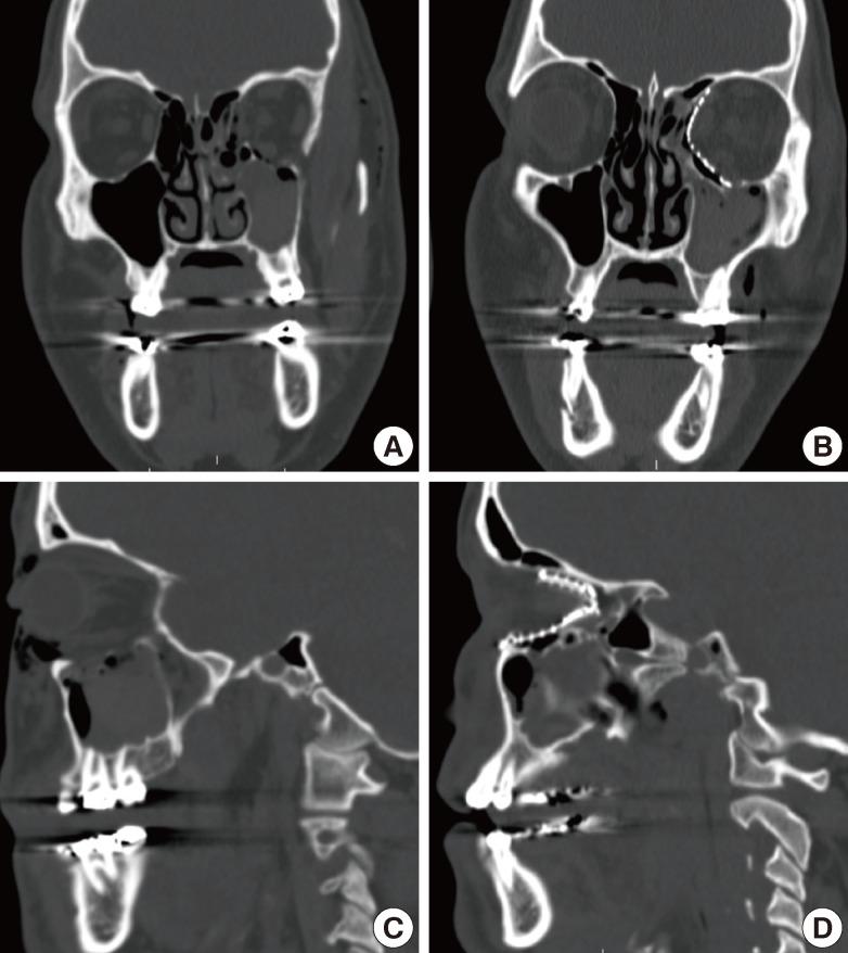 https://cdn.ncbi.nlm.nih.gov/pmc/blobs/f2c6/3385289/d5433532b196/aps-39-11-g004.jpg