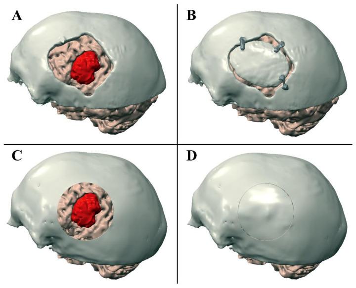 https://cdn.ncbi.nlm.nih.gov/pmc/blobs/f2c7/8507881/8138457cc79c/ijerph-18-09955-g003.jpg