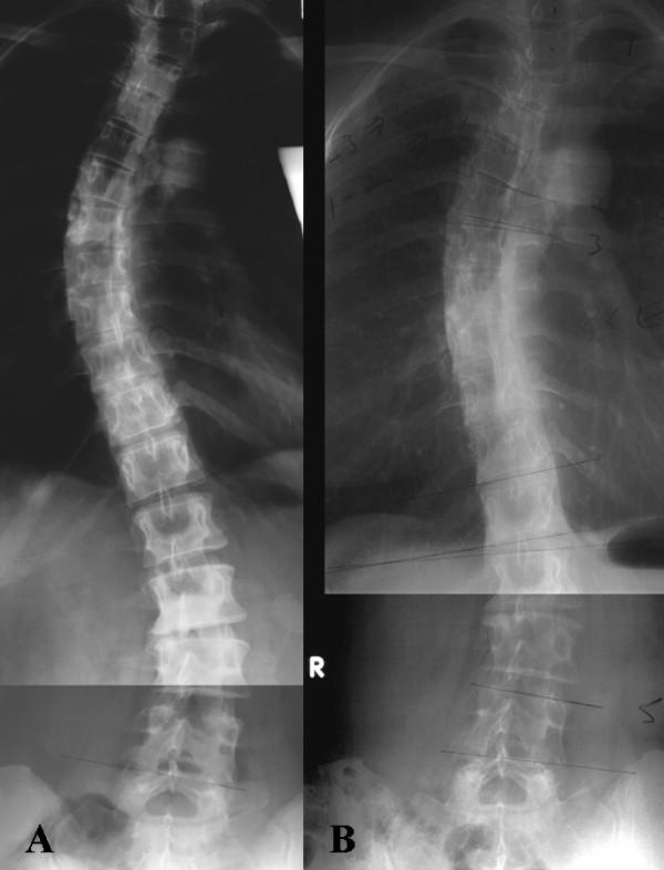 https://cdn.ncbi.nlm.nih.gov/pmc/blobs/f2c8/2808297/8934fbb5499e/1748-7161-4-27-4.jpg