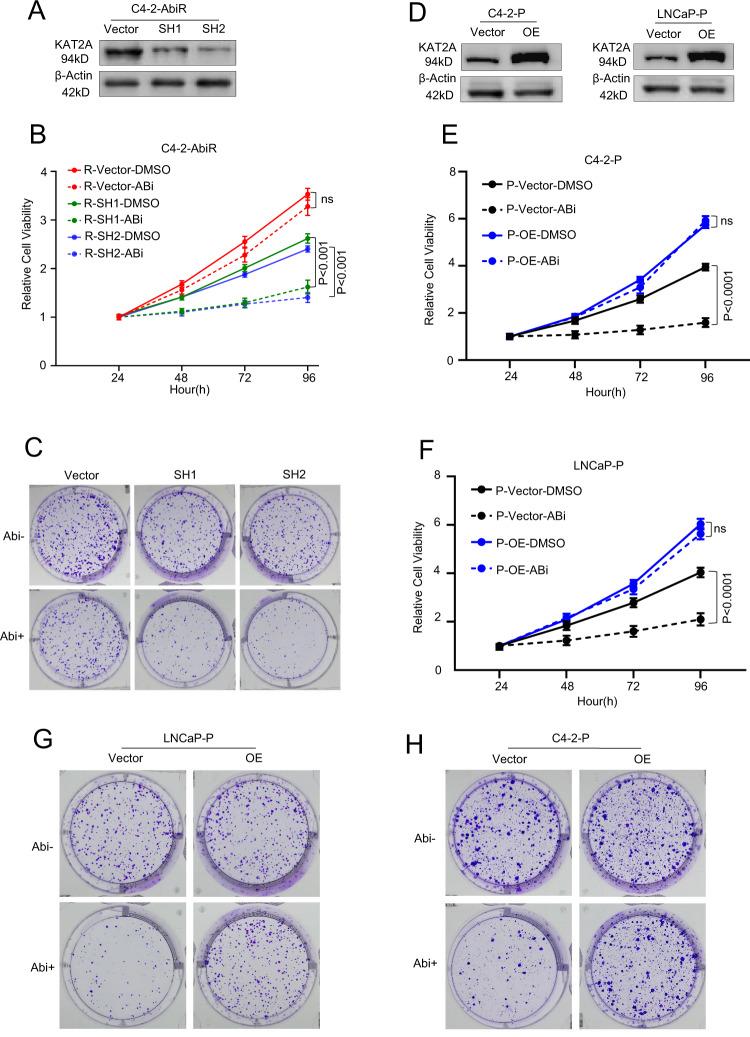 https://cdn.ncbi.nlm.nih.gov/pmc/blobs/f2c8/8357915/564fcc0db6b2/41419_2021_4077_Fig3_HTML.jpg