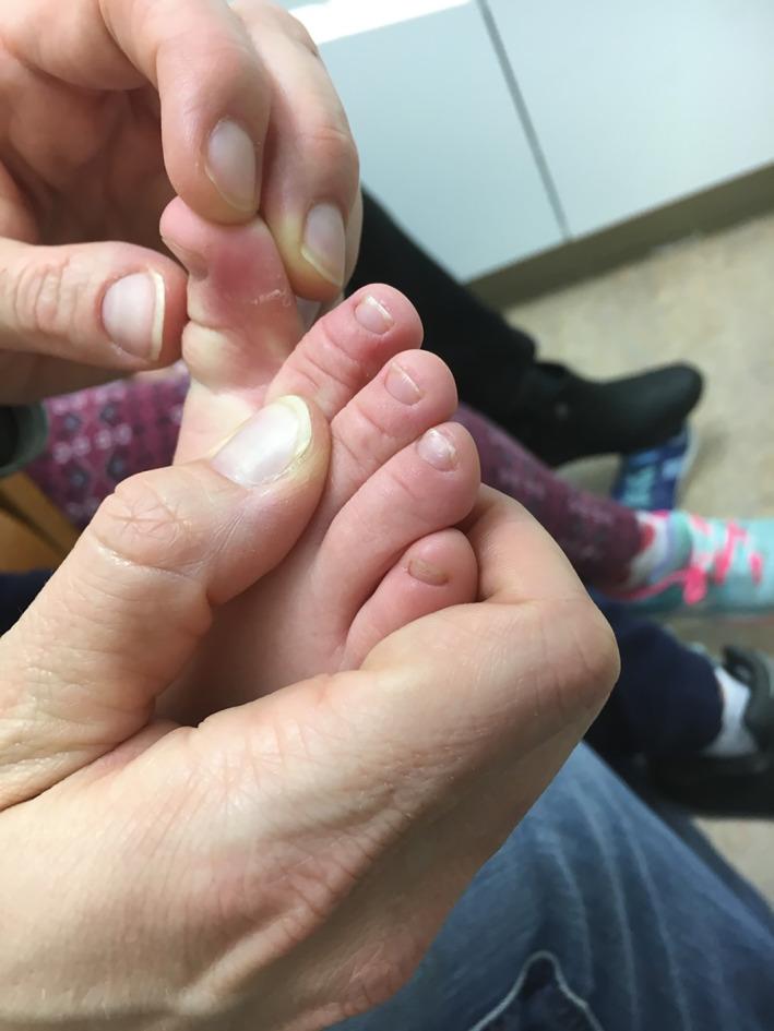 https://cdn.ncbi.nlm.nih.gov/pmc/blobs/f2ca/8177896/77f02ffe094a/HSR2-4-e293-g002.jpg