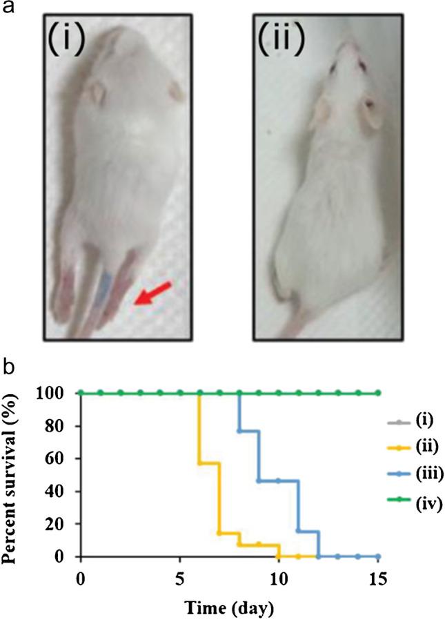 https://cdn.ncbi.nlm.nih.gov/pmc/blobs/f2d0/8616907/f9b7ada6dae9/604_2021_5076_Fig13_HTML.jpg
