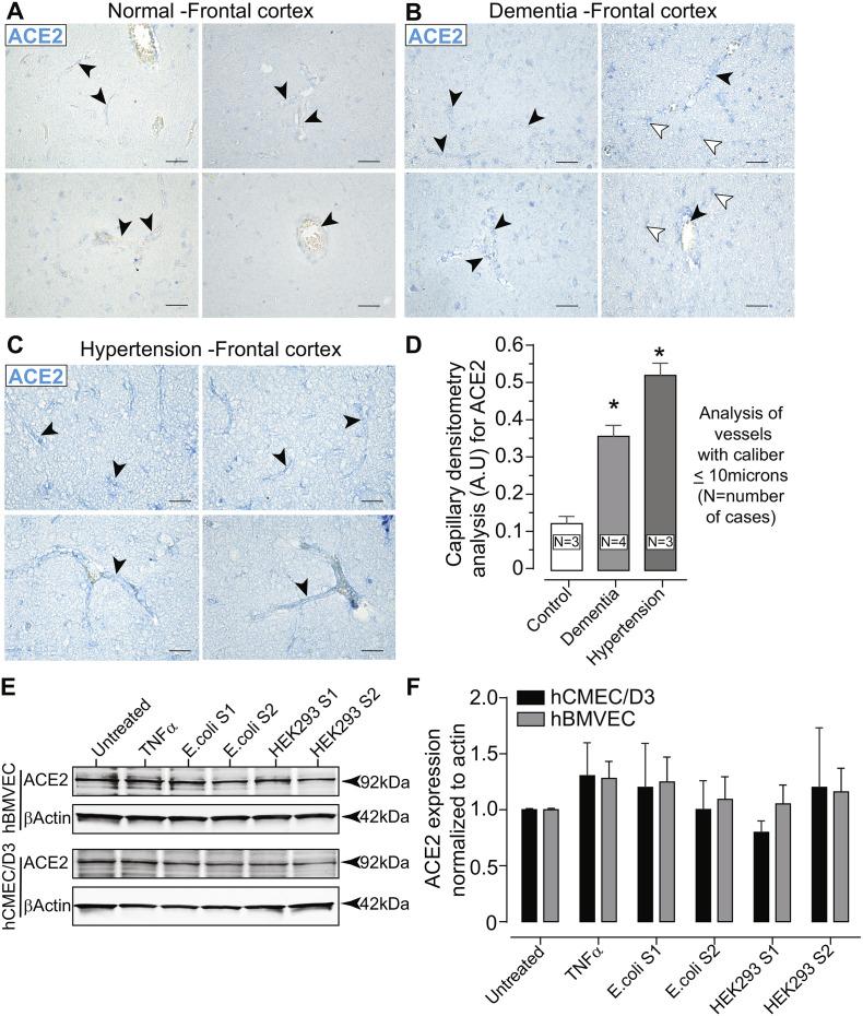 https://cdn.ncbi.nlm.nih.gov/pmc/blobs/f2d1/7547916/05c778a08451/gr1_lrg.jpg