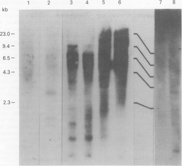 https://cdn.ncbi.nlm.nih.gov/pmc/blobs/f2d5/1968199/4ff9dd20cd43/brjcancer00204-0063-a.jpg