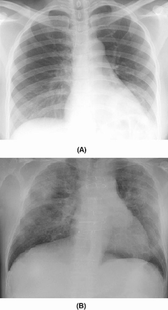 https://cdn.ncbi.nlm.nih.gov/pmc/blobs/f2d7/7658227/c1acf3b2e352/41598_2020_76550_Fig1_HTML.jpg
