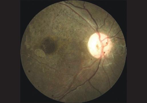 https://cdn.ncbi.nlm.nih.gov/pmc/blobs/f2da/3120264/a184ea723b4e/IJO-59-264a-g002.jpg