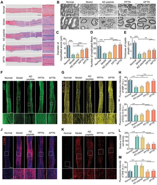 https://cdn.ncbi.nlm.nih.gov/pmc/blobs/f2e0/11848598/05468d93491a/ADVS-12-2405483-g005.jpg