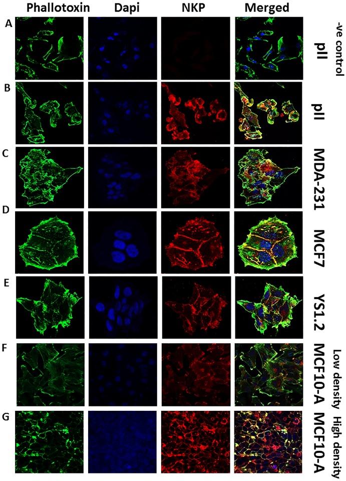 https://cdn.ncbi.nlm.nih.gov/pmc/blobs/f2e3/5874017/d793aee4d5ea/pone.0193779.g003.jpg