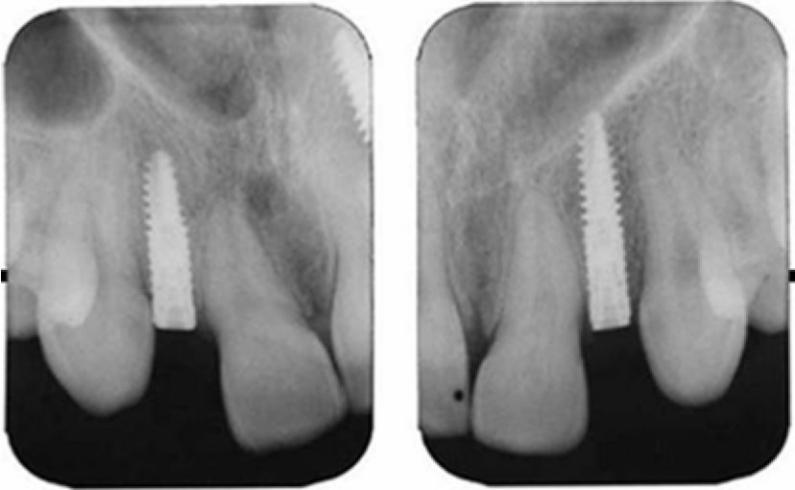 https://cdn.ncbi.nlm.nih.gov/pmc/blobs/f2ed/3075462/762d862c5528/DRJ-6-93-g001.jpg