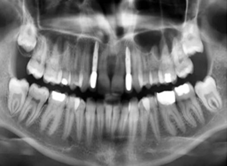 https://cdn.ncbi.nlm.nih.gov/pmc/blobs/f2ed/3075462/a451cc806d25/DRJ-6-93-g006.jpg