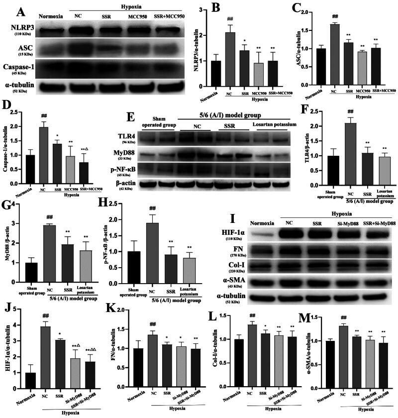 https://cdn.ncbi.nlm.nih.gov/pmc/blobs/f2f0/12090266/3a226a1612e5/IRNF_A_2502875_F0008_B.jpg