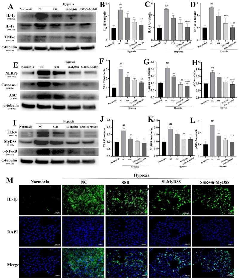 https://cdn.ncbi.nlm.nih.gov/pmc/blobs/f2f0/12090266/3ec2499cc64d/IRNF_A_2502875_F0009_C.jpg