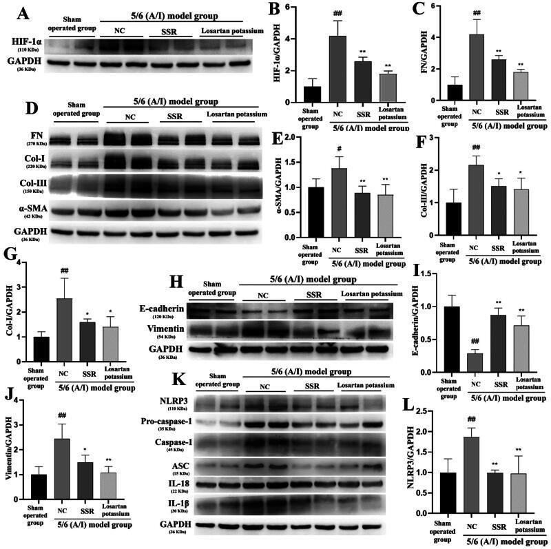 https://cdn.ncbi.nlm.nih.gov/pmc/blobs/f2f0/12090266/56bf9d3d43fc/IRNF_A_2502875_F0005_B.jpg