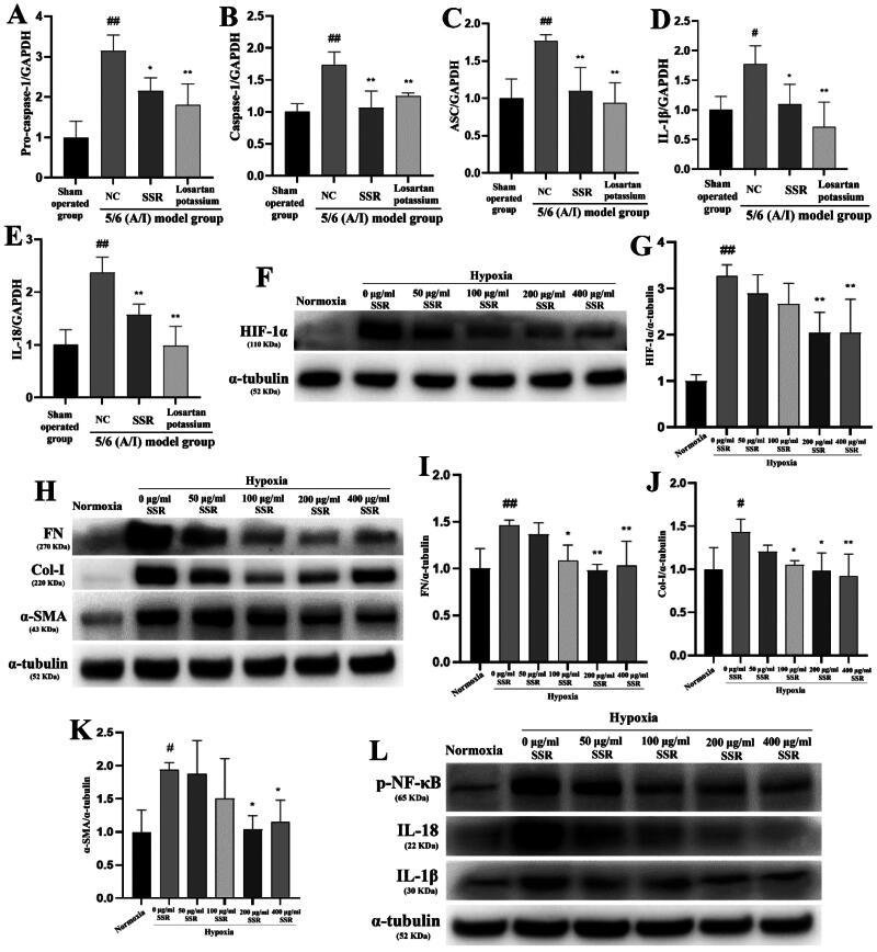 https://cdn.ncbi.nlm.nih.gov/pmc/blobs/f2f0/12090266/8a5f1307c1ae/IRNF_A_2502875_F0006_B.jpg