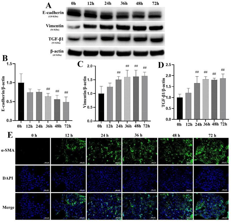 https://cdn.ncbi.nlm.nih.gov/pmc/blobs/f2f0/12090266/98d2c94803e1/IRNF_A_2502875_F0003_C.jpg