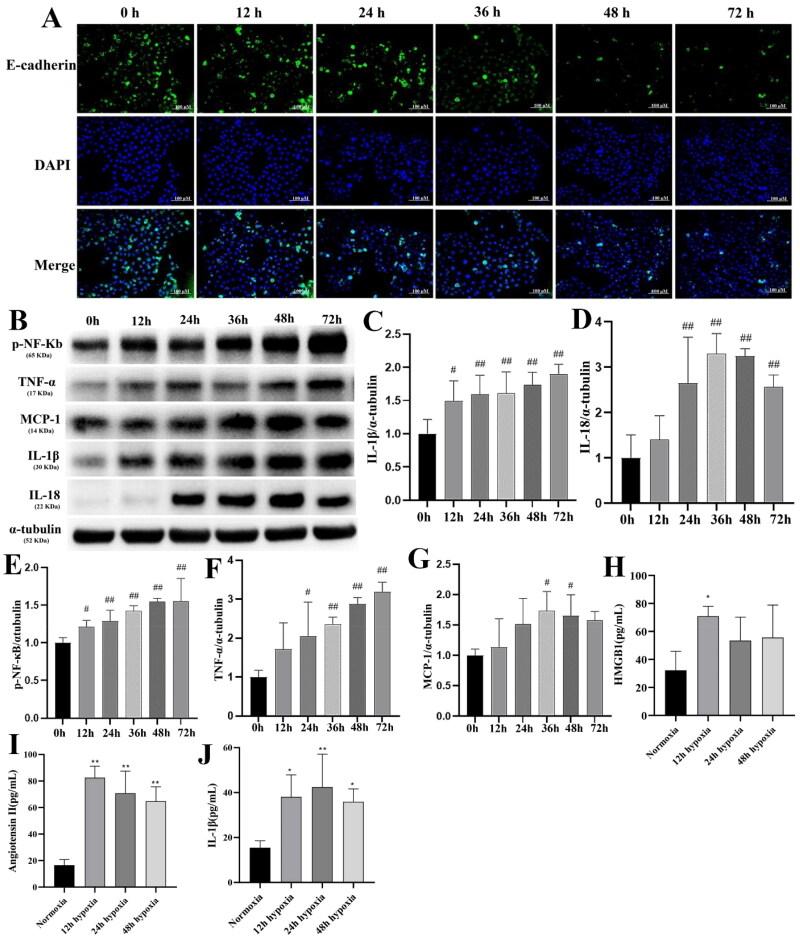 https://cdn.ncbi.nlm.nih.gov/pmc/blobs/f2f0/12090266/f4139a06bcb0/IRNF_A_2502875_F0004_C.jpg