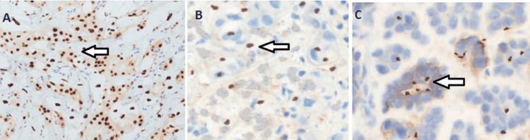 https://cdn.ncbi.nlm.nih.gov/pmc/blobs/f2f1/10961105/8ef21be680ed/cureus-0016-00000054765-i01.jpg