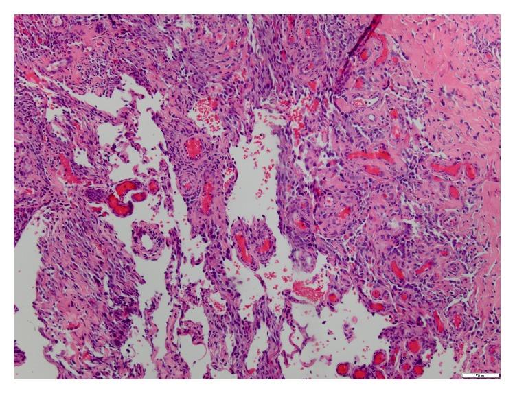 https://cdn.ncbi.nlm.nih.gov/pmc/blobs/f2f8/4276302/654f699f29d4/CRIONM2014-657876.003.jpg