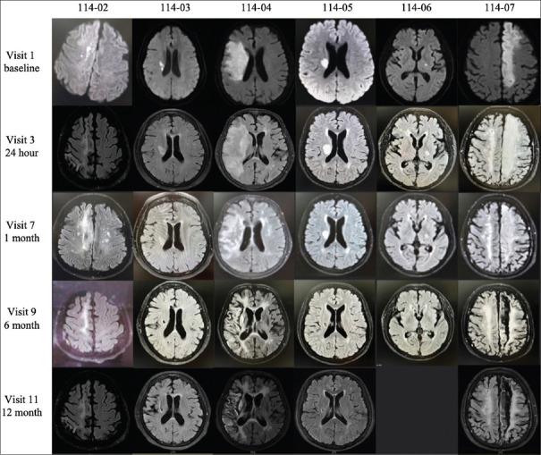 https://cdn.ncbi.nlm.nih.gov/pmc/blobs/f2ff/12306862/7ca0b6c6006a/TCMJ-37-321-g002.jpg