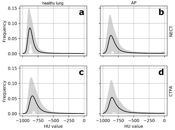 https://cdn.ncbi.nlm.nih.gov/pmc/blobs/f304/8143124/0ace46964fe4/diagnostics-11-00738-g002.jpg