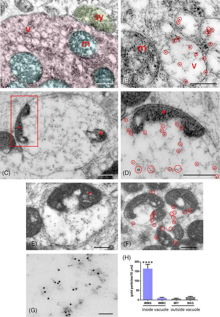 https://cdn.ncbi.nlm.nih.gov/pmc/blobs/f309/9616096/d2c94ba47f5c/BPA-32-e13078-g011.jpg