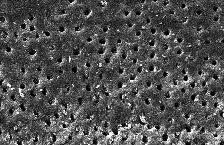 https://cdn.ncbi.nlm.nih.gov/pmc/blobs/f30c/10349660/e10465dfd2ce/cureus-0015-00000040467-i02.jpg