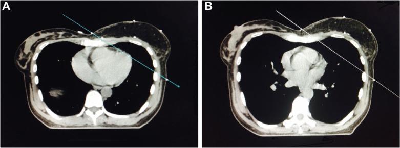 https://cdn.ncbi.nlm.nih.gov/pmc/blobs/f30f/5476442/1d197bf96ecb/bctt-9-437Fig1.jpg