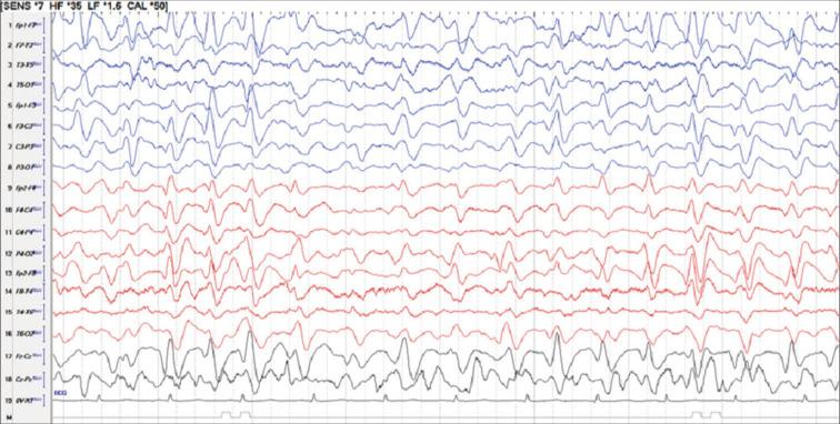 https://cdn.ncbi.nlm.nih.gov/pmc/blobs/f310/10927049/54488565caac/JNRP-15-156-g003.jpg