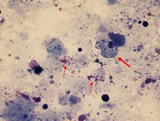 https://cdn.ncbi.nlm.nih.gov/pmc/blobs/f311/11322829/529bdbad3a59/ERR-0064-2024.02.jpg