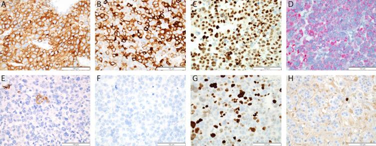 https://cdn.ncbi.nlm.nih.gov/pmc/blobs/f317/11389717/abcd42062761/CMAR-16-1141-g0002.jpg