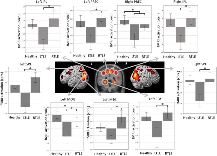 https://cdn.ncbi.nlm.nih.gov/pmc/blobs/f322/10839411/d61302e226b2/EPI4-9-287-g002.jpg