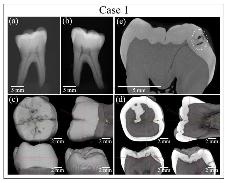 https://cdn.ncbi.nlm.nih.gov/pmc/blobs/f322/7662967/4dba1cdcf2b9/materials-13-04900-g003.jpg