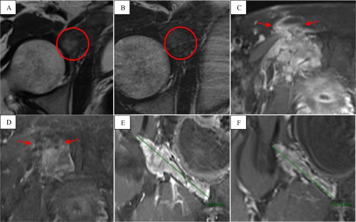 https://cdn.ncbi.nlm.nih.gov/pmc/blobs/f328/11338108/4d2141248e34/gr5.jpg