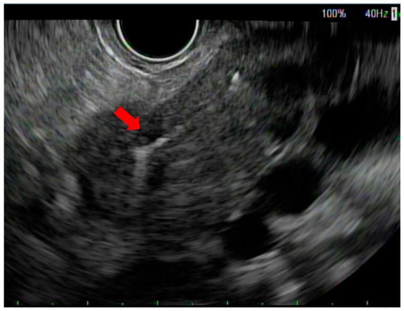https://cdn.ncbi.nlm.nih.gov/pmc/blobs/f32d/10670468/6ac8c323928e/cancers-15-05355-g001.jpg