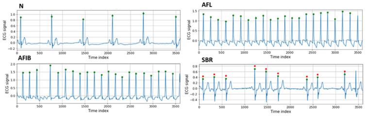 https://cdn.ncbi.nlm.nih.gov/pmc/blobs/f32e/9952353/8a62c6ee6474/bioengineering-10-00196-g003.jpg