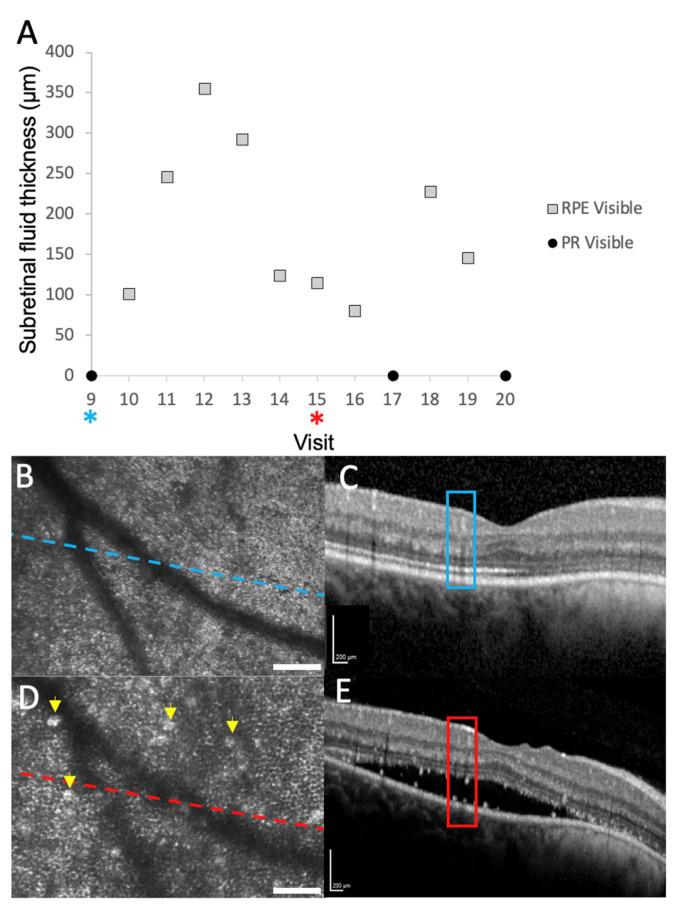https://cdn.ncbi.nlm.nih.gov/pmc/blobs/f334/12346624/05a1b4e0f1bf/diagnostics-15-01904-g003.jpg