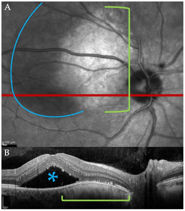 https://cdn.ncbi.nlm.nih.gov/pmc/blobs/f334/12346624/42f3a4ef0ea9/diagnostics-15-01904-g001.jpg