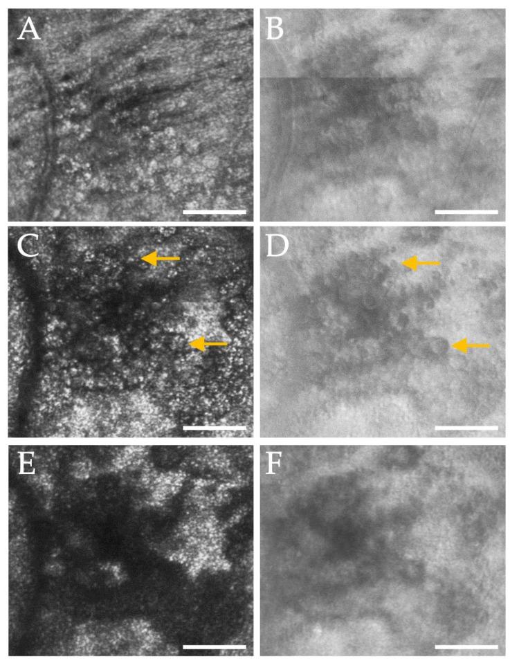 https://cdn.ncbi.nlm.nih.gov/pmc/blobs/f334/12346624/612864a2f4aa/diagnostics-15-01904-g005.jpg