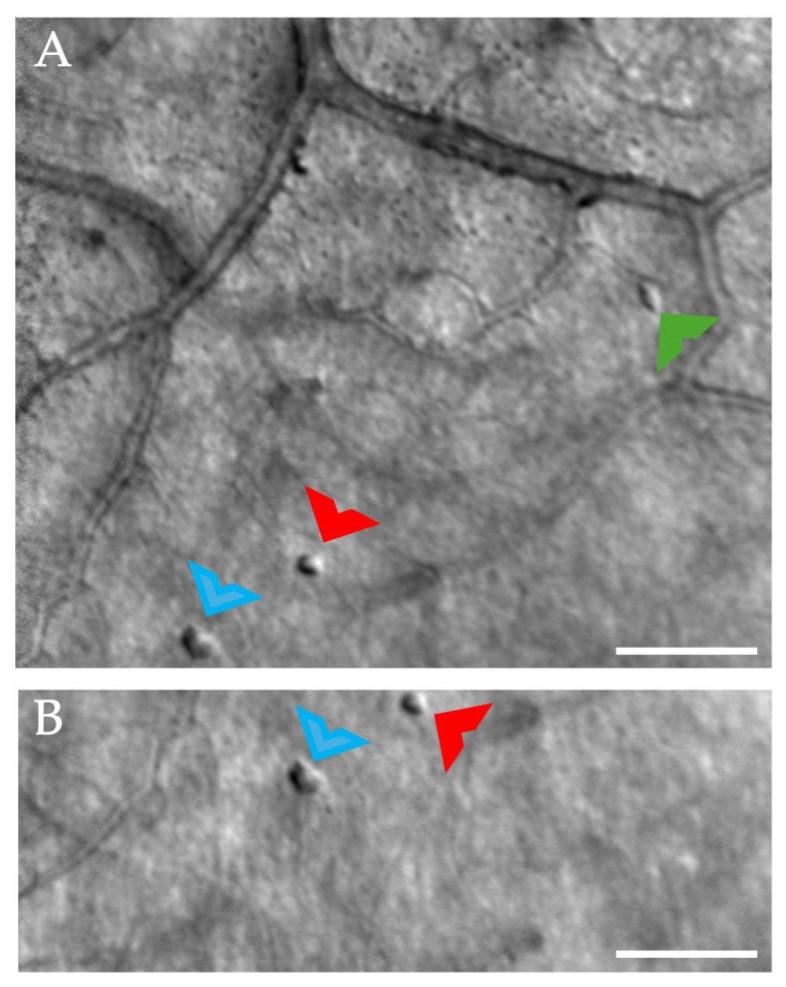 https://cdn.ncbi.nlm.nih.gov/pmc/blobs/f334/12346624/6672fe1633d1/diagnostics-15-01904-g006.jpg