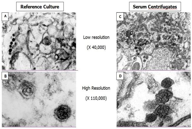 https://cdn.ncbi.nlm.nih.gov/pmc/blobs/f33a/2894221/828cc0e8df21/ijmsv07p0181g03.jpg
