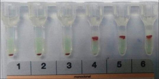 https://cdn.ncbi.nlm.nih.gov/pmc/blobs/f33d/6910034/6248c0687edb/AJTS-13-110-g001.jpg