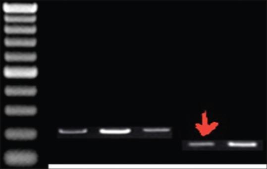 https://cdn.ncbi.nlm.nih.gov/pmc/blobs/f33d/6910034/e549699d6a35/AJTS-13-110-g003.jpg