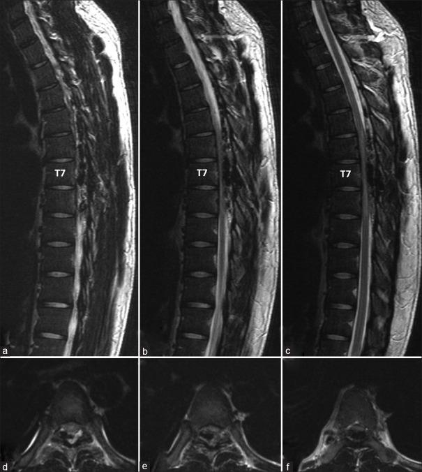 https://cdn.ncbi.nlm.nih.gov/pmc/blobs/f343/7869281/48ea1b14eeea/AJNS-15-1041-g001.jpg