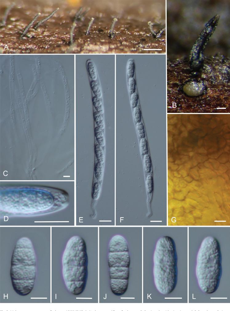 https://cdn.ncbi.nlm.nih.gov/pmc/blobs/f34e/10964405/e5094dea740f/fuse-2023-11-7-g003.jpg
