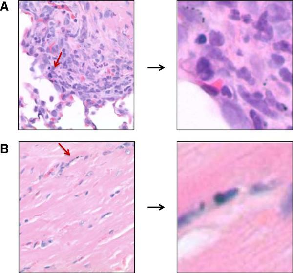 https://cdn.ncbi.nlm.nih.gov/pmc/blobs/f352/4082425/ad3ebd53660e/1743-8977-11-26-7.jpg