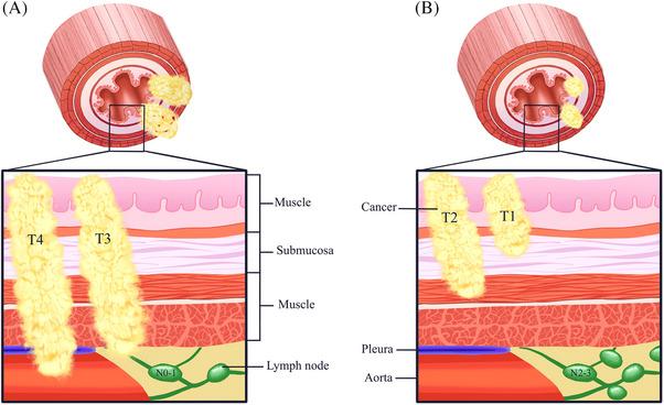 https://cdn.ncbi.nlm.nih.gov/pmc/blobs/f353/11934889/001cc5e83a8c/PRO6-8-218-g004.jpg