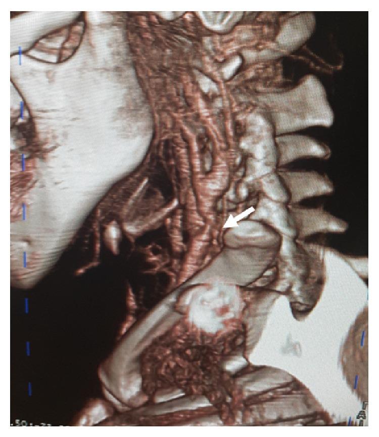 https://cdn.ncbi.nlm.nih.gov/pmc/blobs/f356/4689903/bd6a3ad87492/CRIRA2015-903150.002.jpg